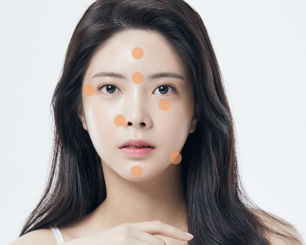 보톡스 시술 부위 안내 이미지