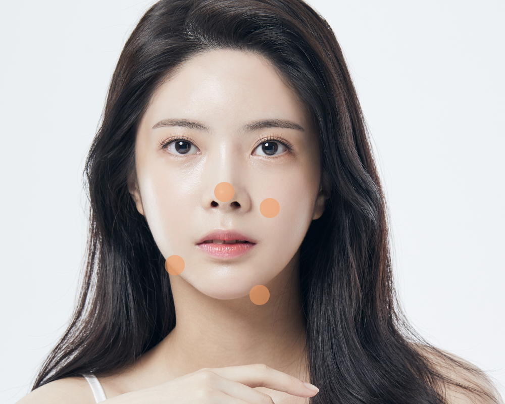 보톡스 시술 부위 안내 이미지