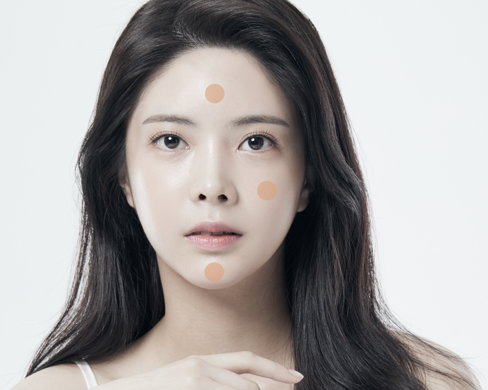 흉터필러 시술 부위 안내 이미지