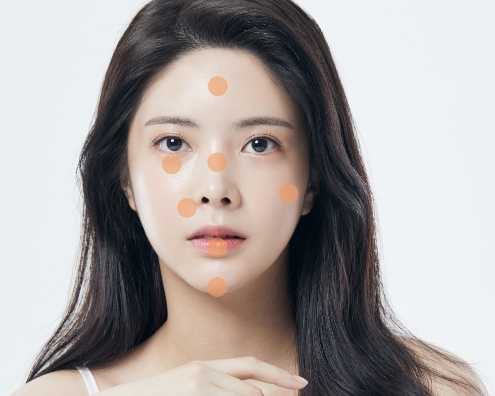 보톡스 시술 부위 안내 이미지